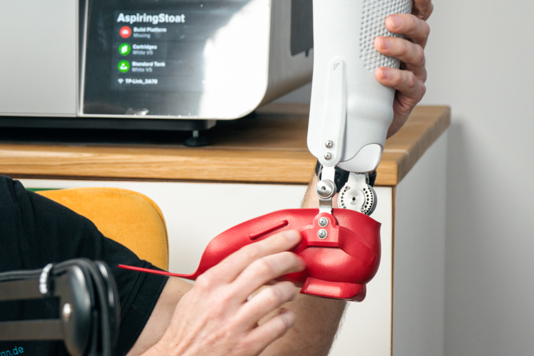 Individuelle Prothese aus der 3D Druck Orthopädietechnik, gefertigt mit HP Multi Jet Fusion Technologie.