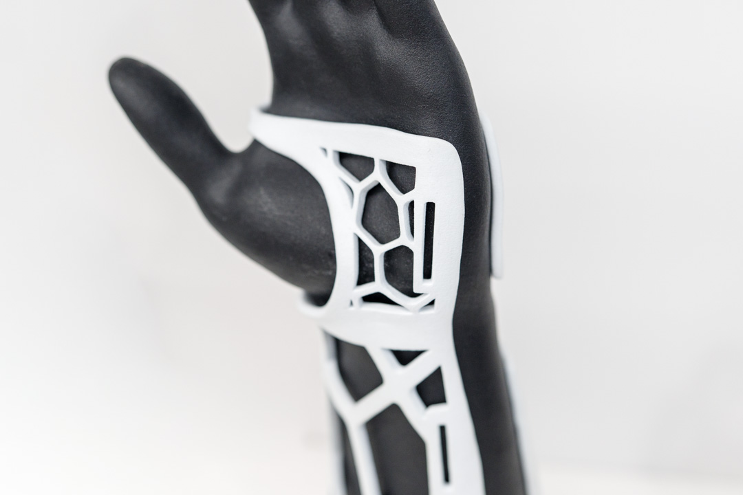 Weiße 3D-gedruckte Orthese an einem Handmodell